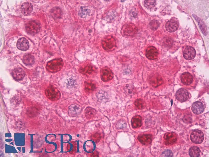 IHC-plus™ Ubiquitin Antibody (clone P4G7-H11)