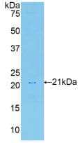 HGF / Hepatocyte Growth Factor Antibody (aa306-471, PE)