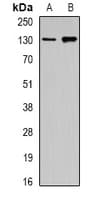 GOLGA2 / GM130 Antibody