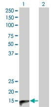 Monoclonal Mouse anti-Human CALCA Antibody (clone 4B10, WB)
