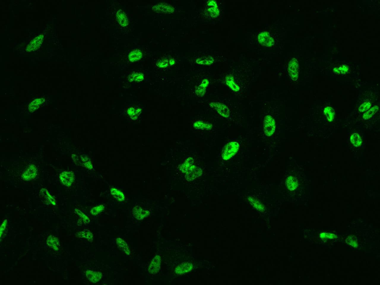 ERCC5 / XPG Antibody