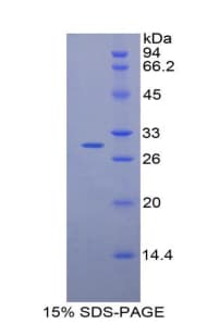 Mouse GPT2 / ALT2 Protein (Recombinant His)