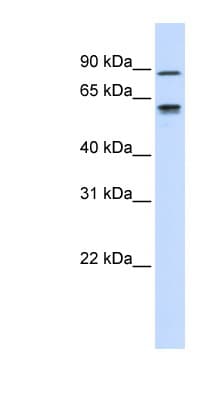 Fibulin-3 / EFEMP1 Antibody (C-Terminus)