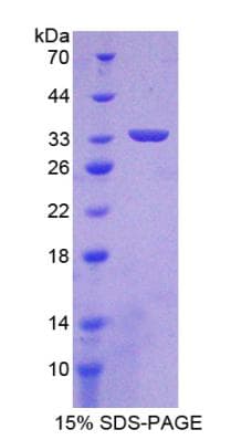 Human HIF1A / HIF1 Alpha Protein (Recombinant His-GST)