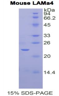 Mouse LAMA4 / Laminin Alpha 4 Protein (Recombinant His)