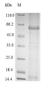 BK Polyomavirus BK Virus VP1 Protein (Recombinant 10His-SUMO, N-terminus + Myc, C-terminus)