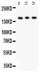 INSR / Insulin Receptor Antibody (aa1353-1372)