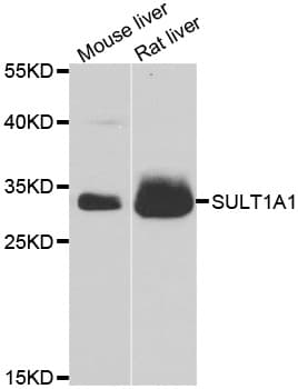 SULT1A1 / Sulfotransferase 1A1 Antibody