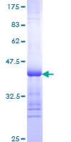 Human TG / Thyroglobulin Protein (Recombinant GST, N-terminus)