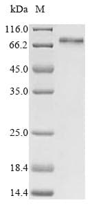 Human YAP / YAP1 Protein (Recombinant 6His-B2M, N-terminus)