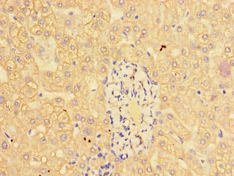 Polyclonal Rabbit anti-Human CTSL / Cathepsin L Antibody (IHC, IF)