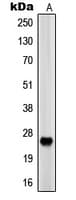PRSS33 Antibody (Internal)