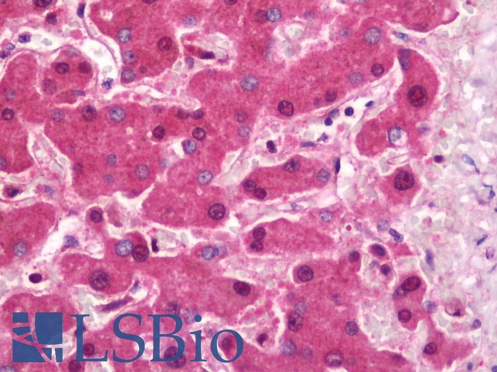 IHC-plus™ RAD23B / HR23B Antibody (aa27-76)