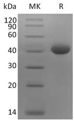 Coronavirus SARS-CoV-2 Spike Glycoprotein (Recombinant AVI-6His, C-terminus)