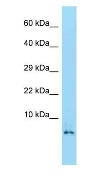 Polyclonal Rabbit anti-Mouse HMGN2 Antibody (C-Terminus, WB)