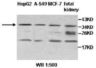 ZNF101 Antibody (aa78-362)