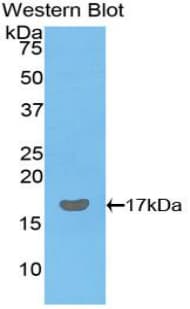 LGALS9 / Galectin 9 Antibody (aa17-148, Biotin)