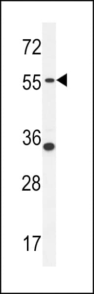 PDE12 Antibody (aa362-390)