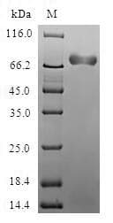 Human CHIA / Amcase Protein (Recombinant GST, N-terminus)
