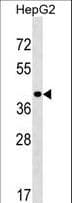 PPIL5 Antibody (aa127-153)
