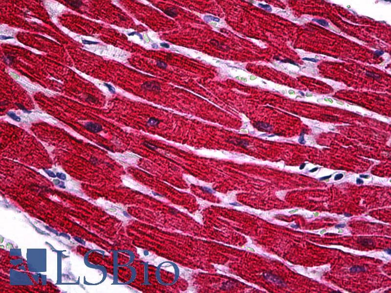 PathPlus™ Monoclonal Mouse anti-Human TNNT2 / CTNT Antibody (IHC)