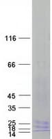 Human LY96 / MD2 / MD-2 Protein (Recombinant Myc-DDK (Flag))