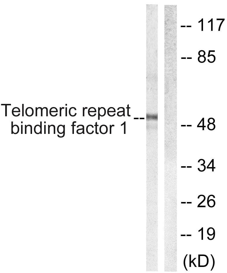 TRF1 / TERF1 Antibody (p219)
