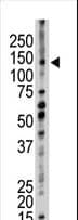 UFD2A / UBE4B Antibody (aa112-142)