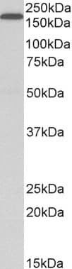 Polyclonal Goat anti-Human LRP5 Antibody (aa1178-1189, IHC, WB)