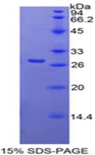 Mouse RARA / RAR Alpha Protein (Recombinant His-T7)