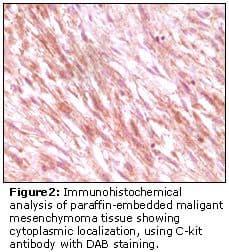 c-Kit / CD117 Antibody (clone 8D7B4, 8D7D4, 7H6B2, 7H6B12)