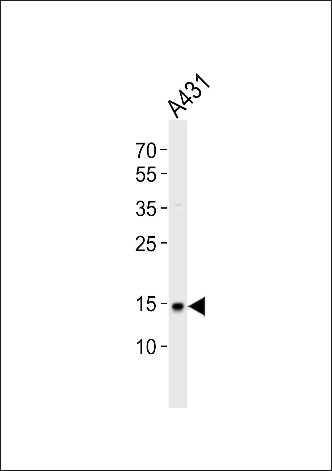 Polyclonal Rabbit anti-Human POLR2H / RPB8 Antibody (aa16-50, WB)