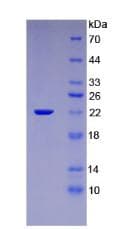 Rat IL-1B / IL-1 Beta Protein (Recombinant His-T7)
