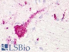 PathPlus™ TAAR5 Antibody (Extracellular Domain)