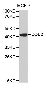 Polyclonal Rabbit anti-Human DDB2 Antibody (IHC, IF, WB)
