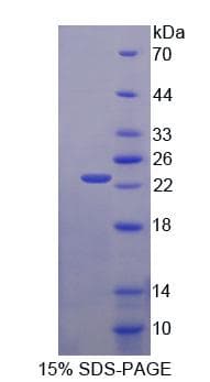 Rat CRYBB2 Protein (Recombinant His, N-Terminal)