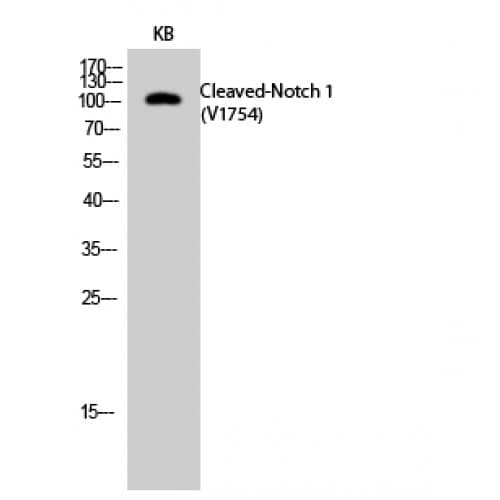 NOTCH1 Antibody (1710-1790 aa, Internal)