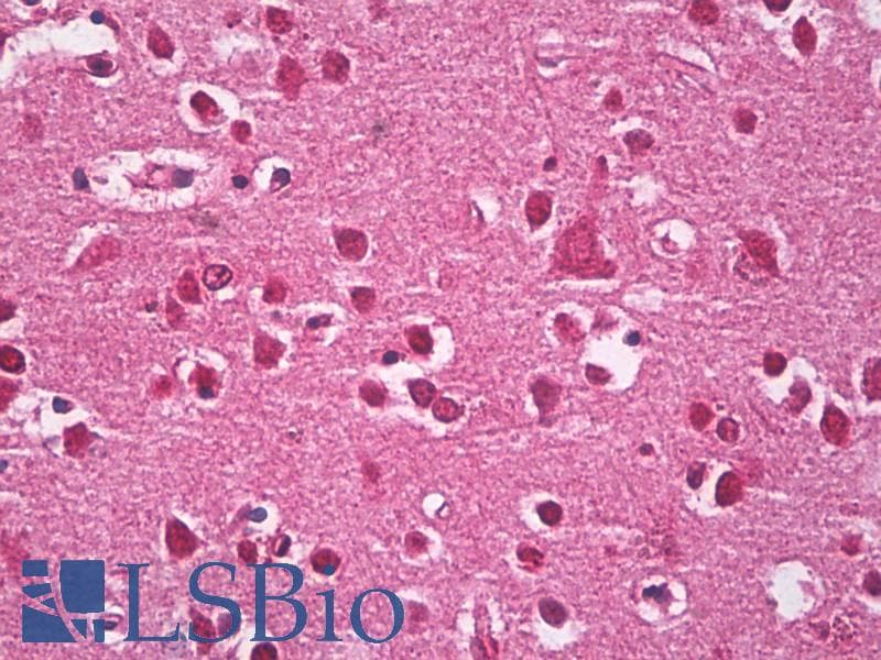 IHC-plus™ Polyclonal Rabbit AHSA1/AHSA2 Antibody (IHC, WB)