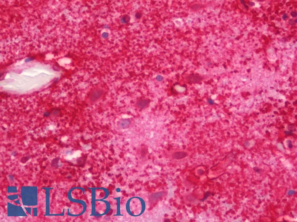 IHC-plus™ AQP4 / Aquaporin 4 Antibody (aa230-260)