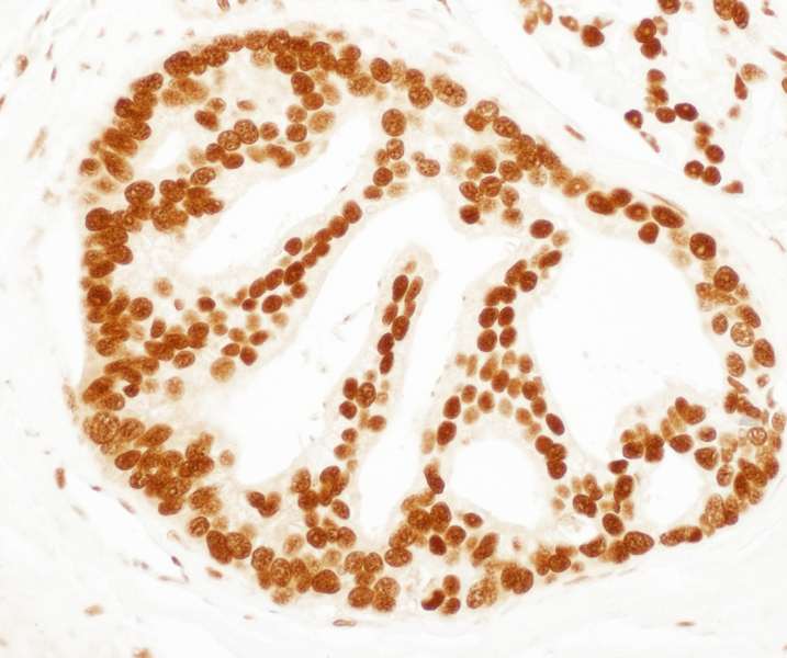 Polyclonal Rabbit anti-Human SET / TAF-I Antibody (aa175-225, IHC, WB)