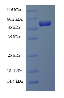 E. coli LPS regulatory protein YciM (Recombinant 6His-SUMO, N-terminus)