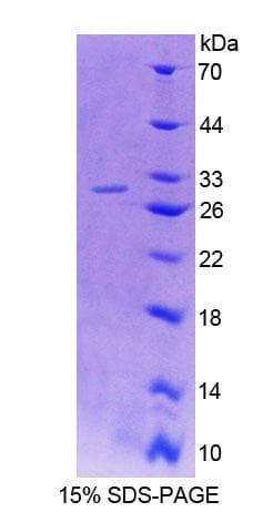 Mouse PLCD1 Protein (Recombinant His-T7, N-terminus)