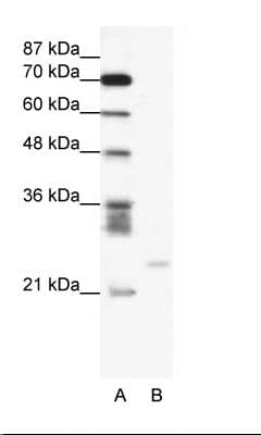 Polyclonal Rabbit anti-Human BCL2A1 Antibody (C-Terminus, WB)
