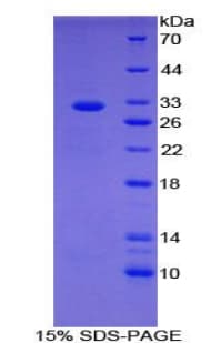 Human FSP27 / CIDEC Protein (Recombinant His-T7)