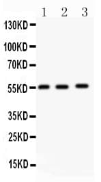 Polyclonal Rabbit anti-Human MMP14 Antibody (aa557-582, WB)