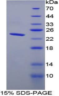 Human Endostatin Protein (Recombinant His-T7)