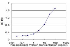 CASR/Calcium Sensing Receptor Antibody (clone 3F12)
