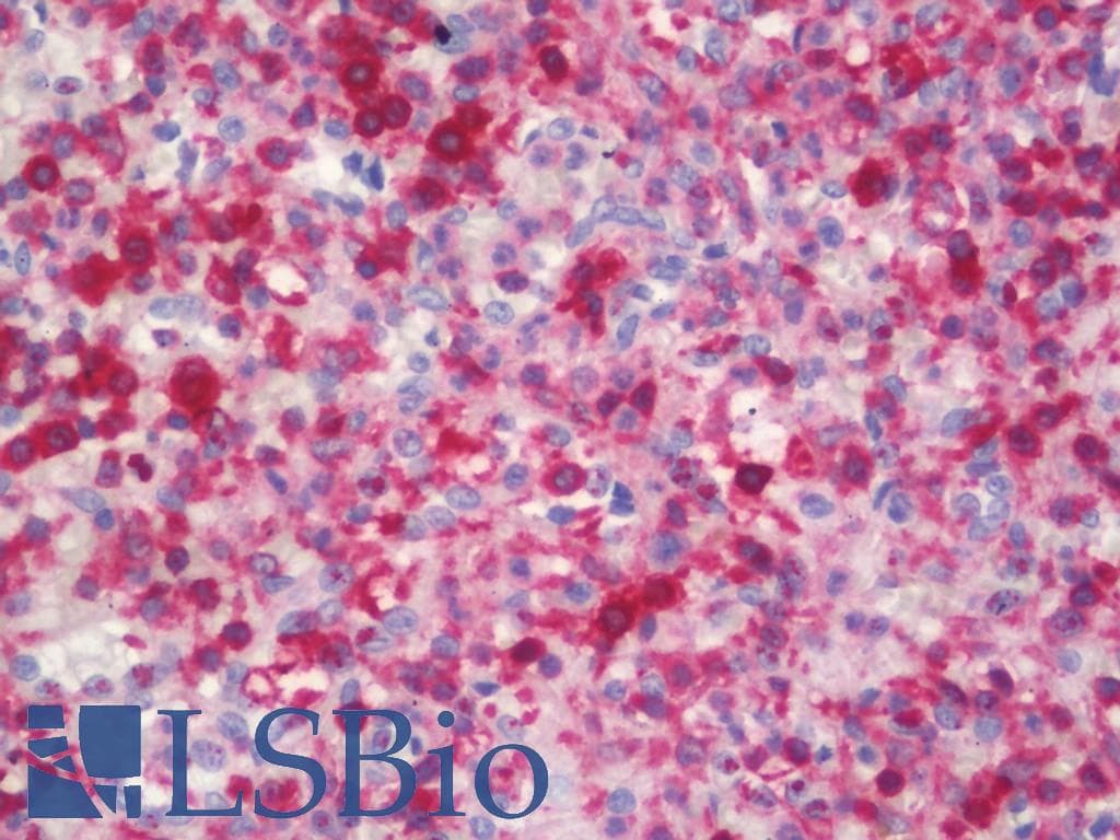 IHC-plus™ ARHGAP25 Antibody (clone 12G4)