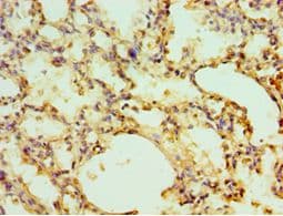 Polyclonal Rabbit anti-Human EGLN1 / PHD2 Antibody (aa301-426, IHC)