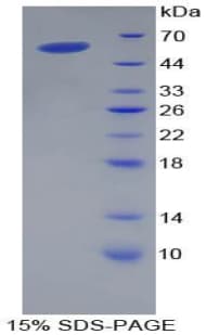 Pig APOA1 / Apolipoprotein A 1 (Recombinant His-GST)